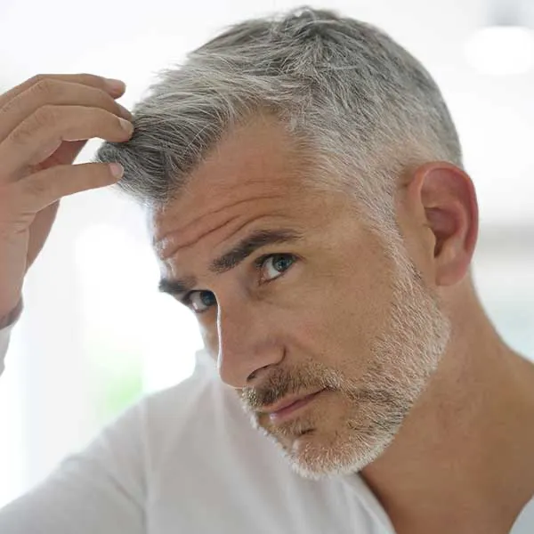 Médecine capillaire et greffe de cheveux à Bruxelles